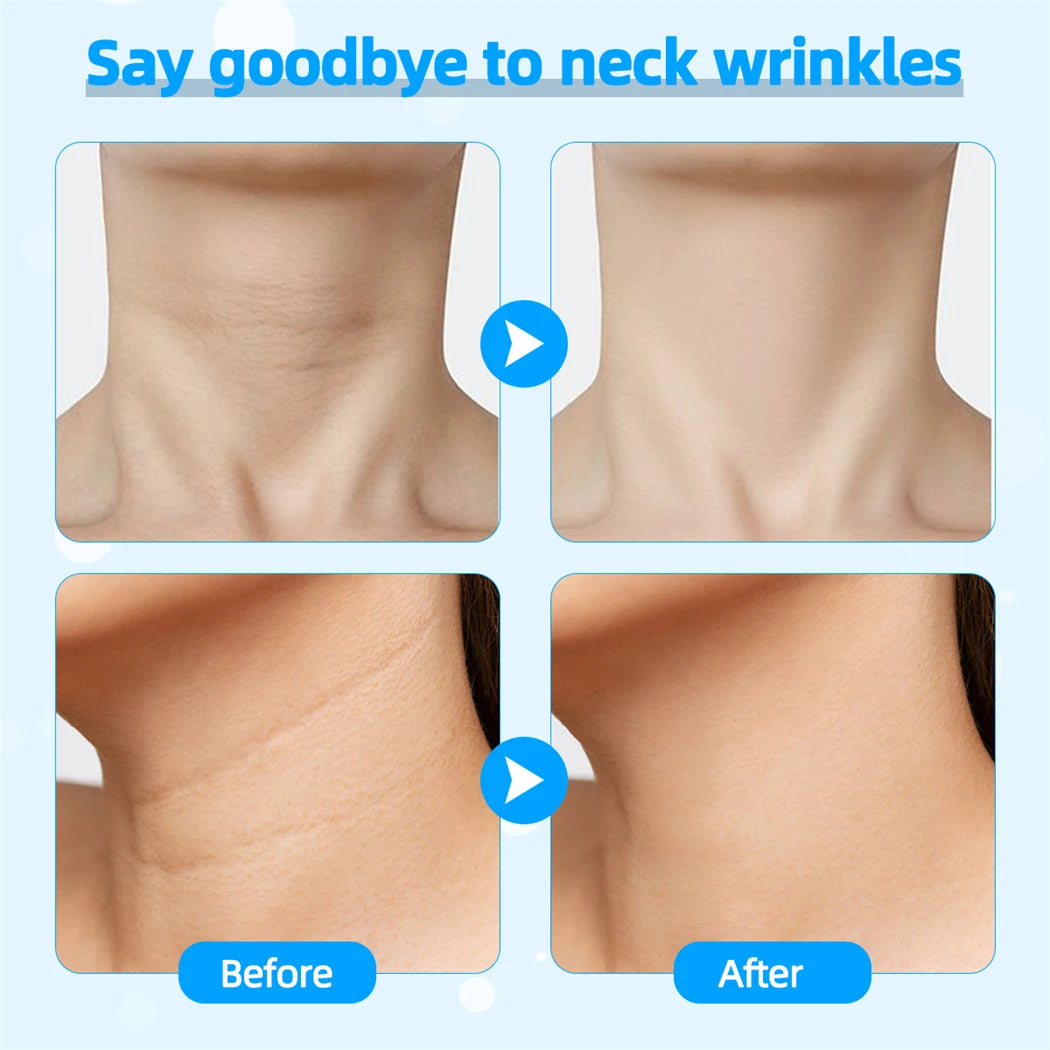 EMS Face & Neck Lifting Device with 4-Color LED
